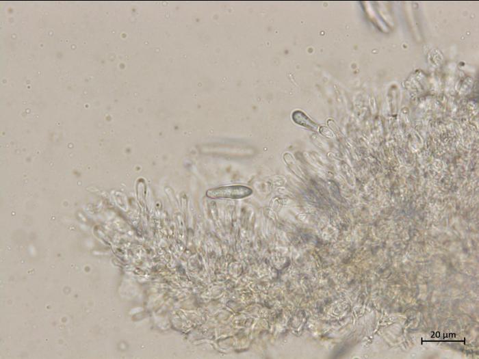 Botryosphaeria_dothidea_2