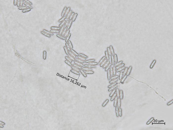 Colletotrichum_siamense_2