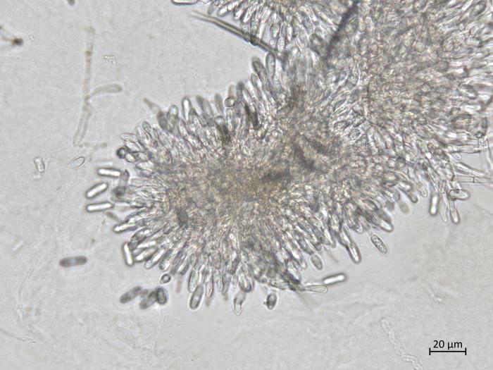 Colletotrichum_siamense_4