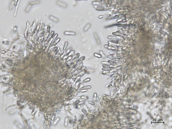 Colletotrichum_siamense_5