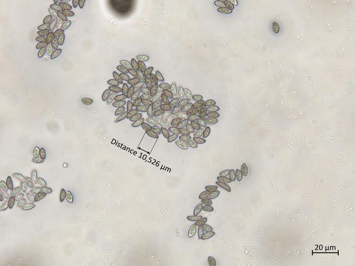 Coniella_diplodiella_3