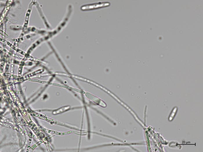 Dactylonectria_torresensis_4