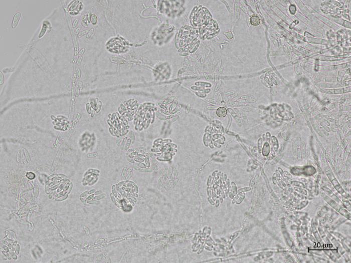 Fusarium_oxysporum_7