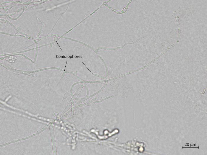 Fusarium_oxysporum_9