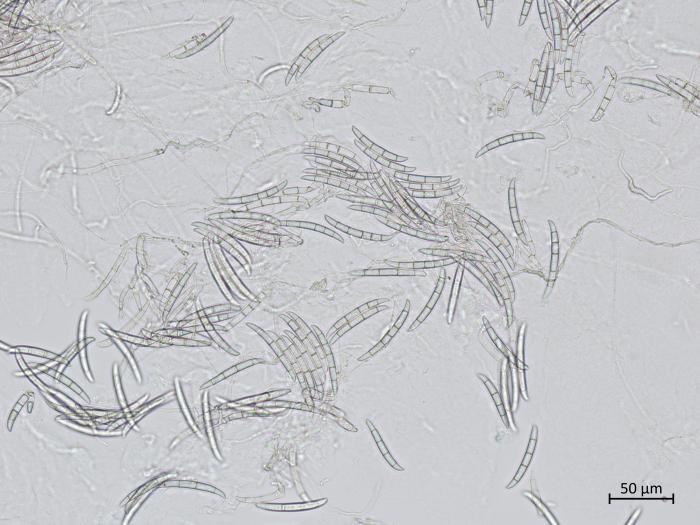 Neocosmospora_solani_2