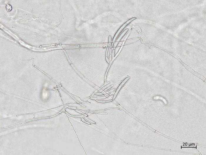 Neocosmospora_solani_5