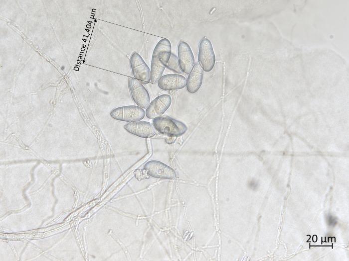 Orbilia_blumenaviensis_4