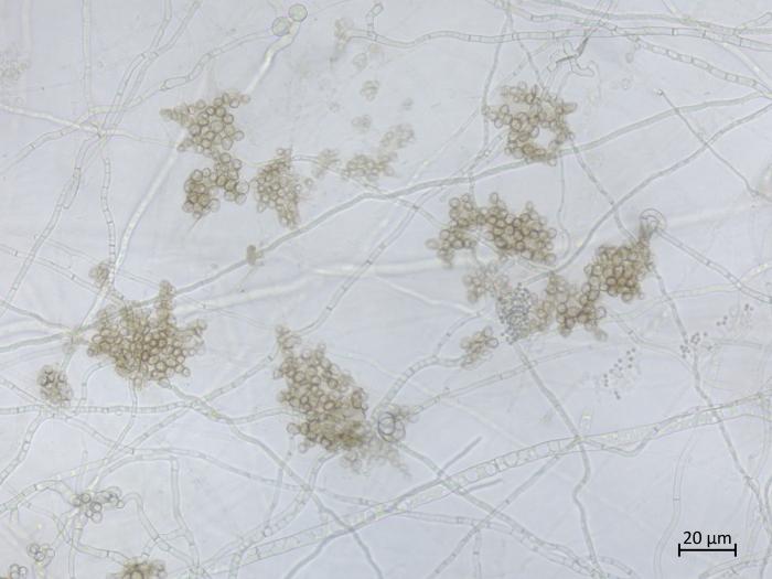 Sclerotinia_sclerotiorum_4