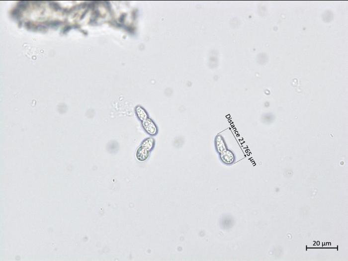 Diplocarpon coronariae