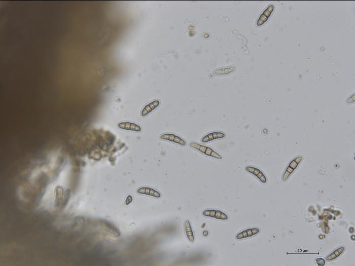 Paraconiothyrium coniothyrium