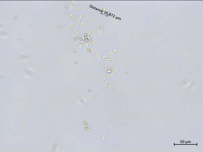 Colletotrichum_boninense_1