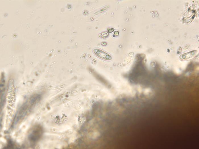 Colletotrichum_gloeosporioides_1