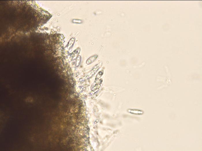 Colletotrichum_gloeosporioides_2