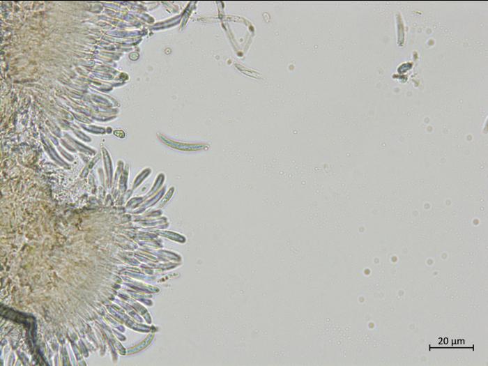Colletotrichum_incanum_1