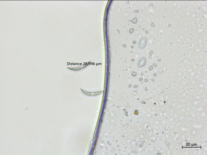 Colletotrichum_incanum_2