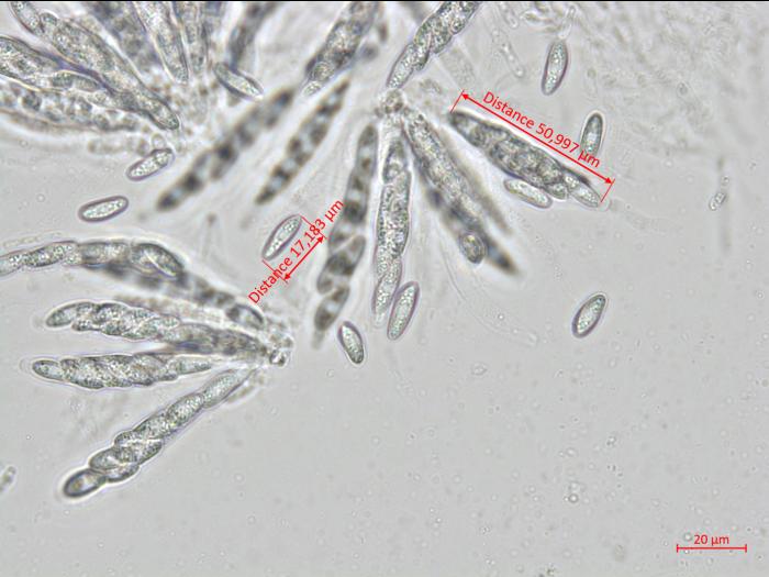 Colletotrichum_salicis_1