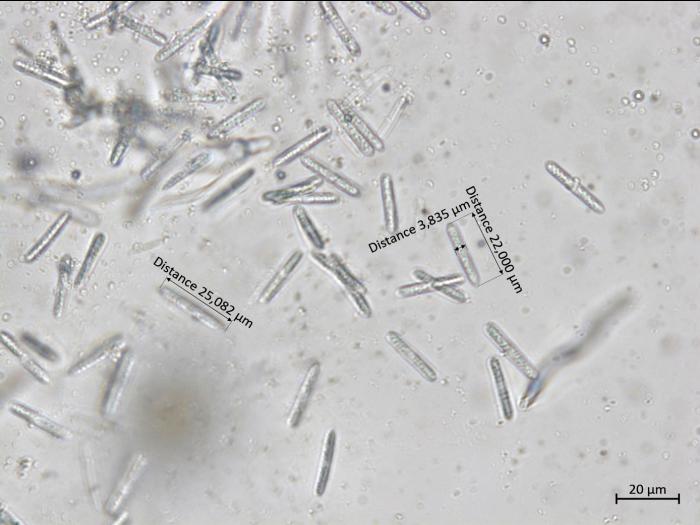 Coleophoma_empetri_3