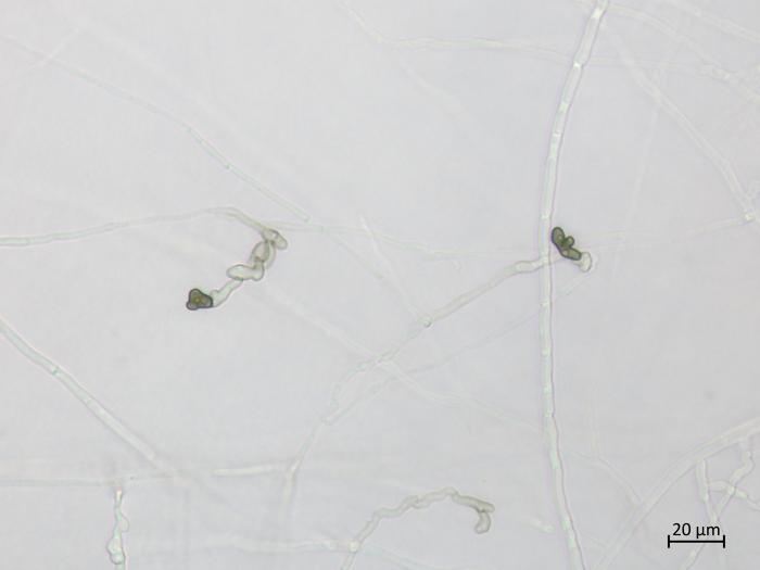 Colletotrichum_coccodes_15