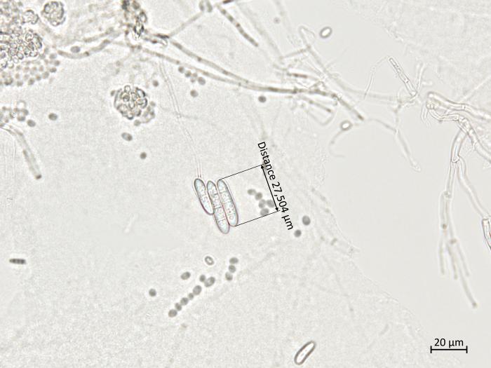 Ilyonectria_liriodendri_3