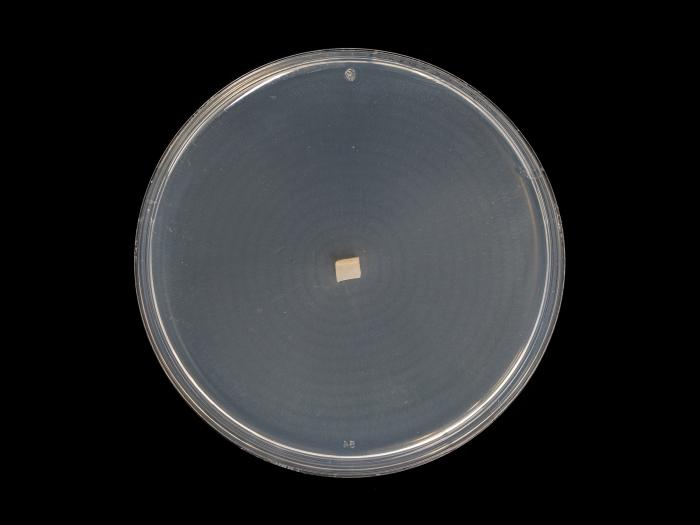 Plectosphaerella_cucumerina_11