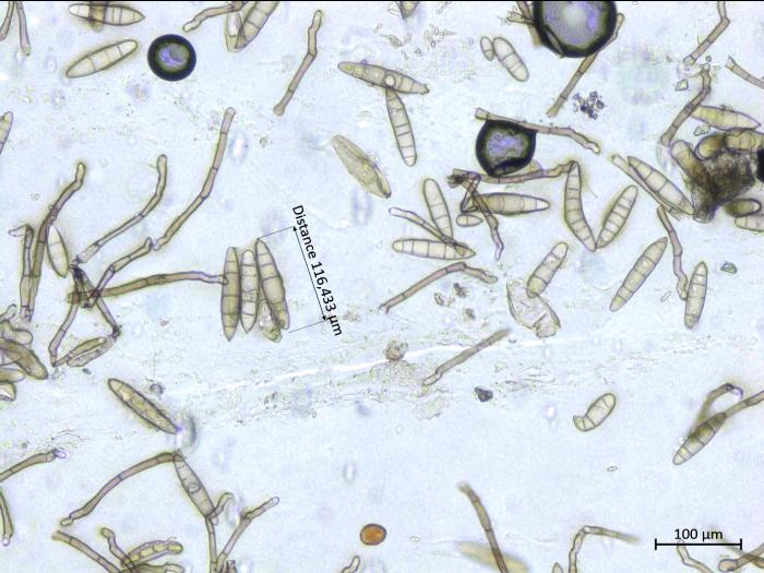 Exserohilum_turcicum_1