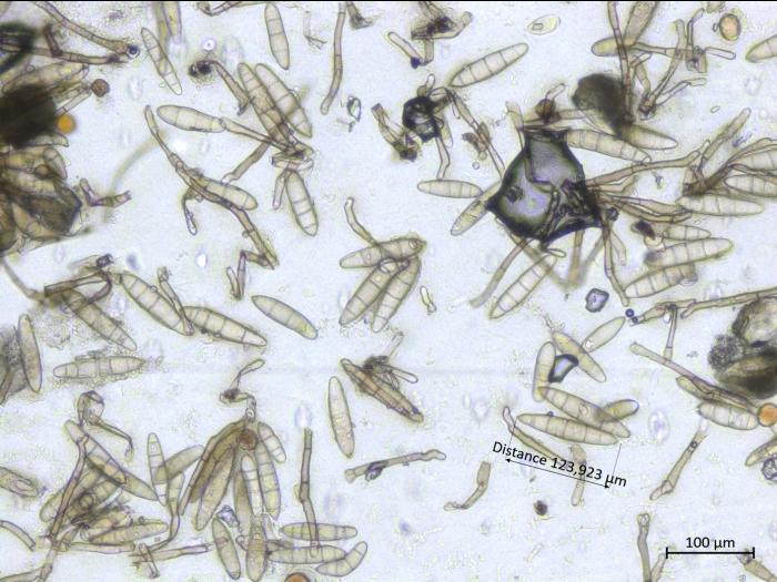 Exserohilum_turcicum_2