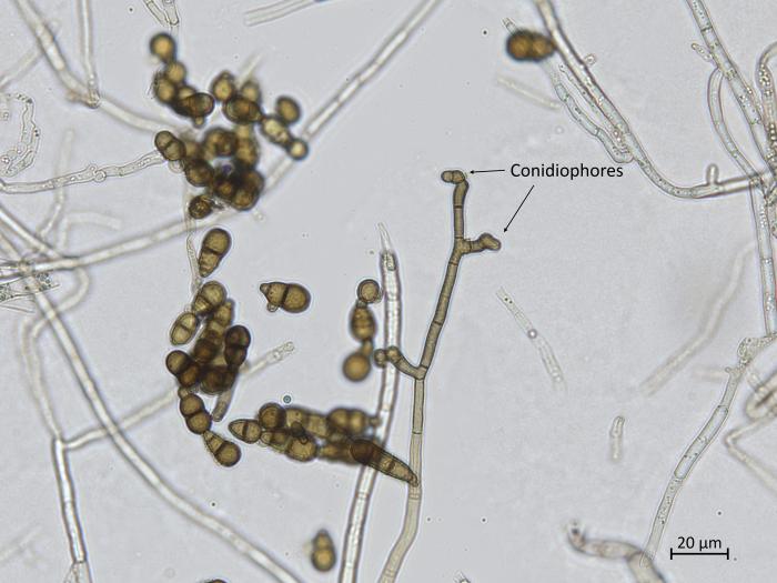 Alternaria_brassicicola_2