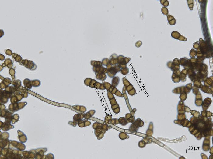 Alternaria_brassicicola_4