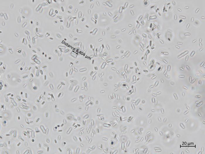 Cadophora_luteo-olivacea_8