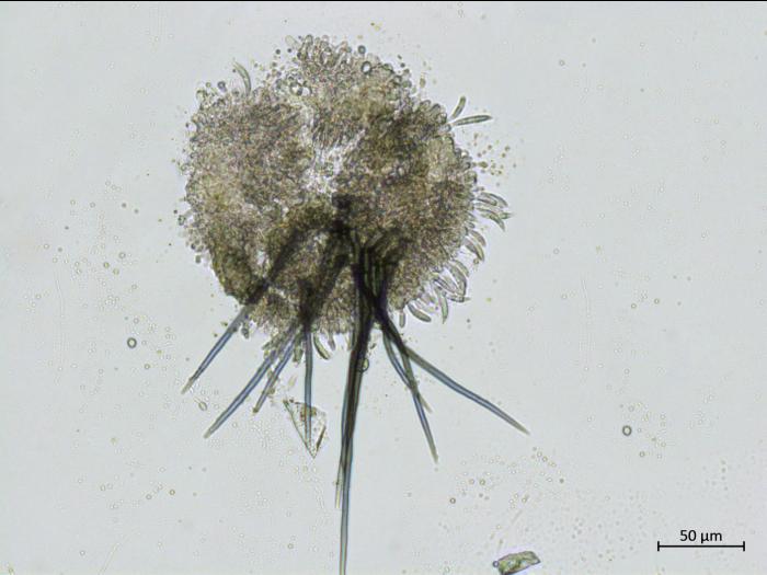 Colletotrichum_incanum_3