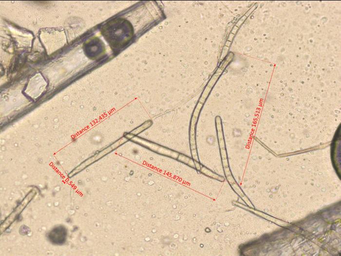 Corynespora_cassiicola_1