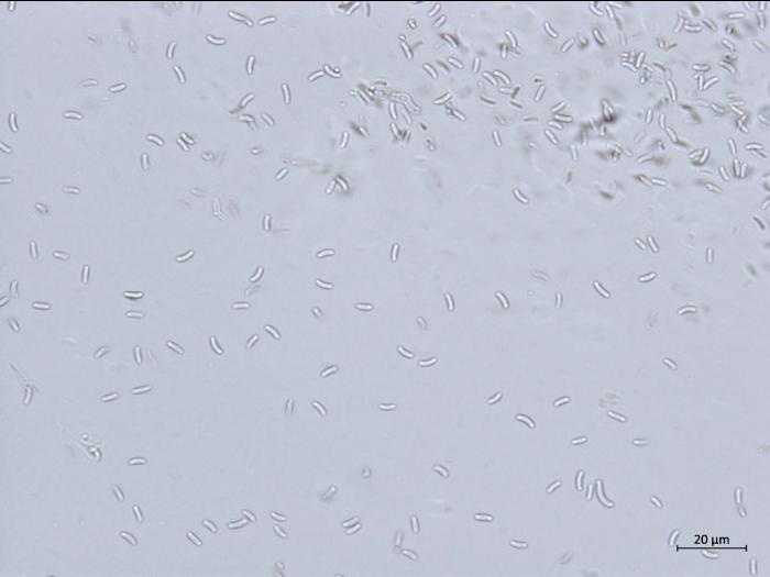 Cytospora_chrysosperma_2