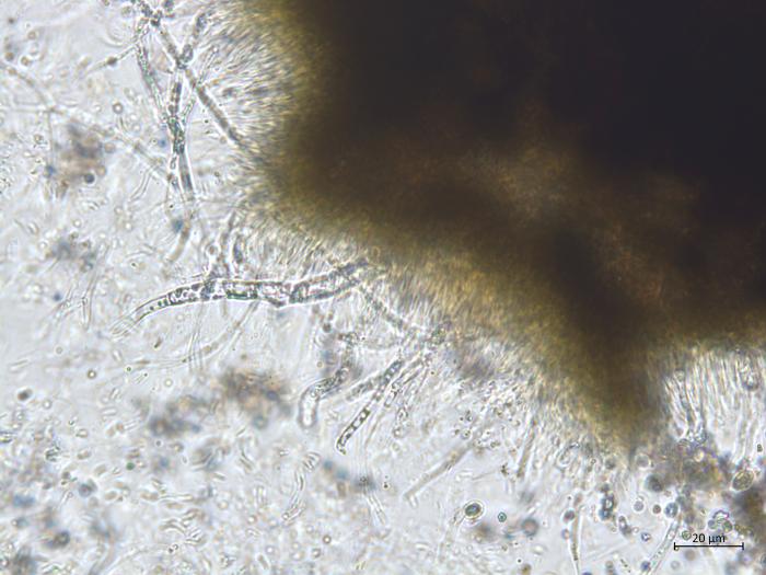 Cytospora_sp_1