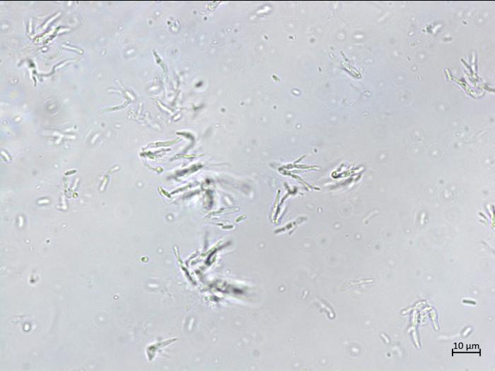 Cytospora_sp_2