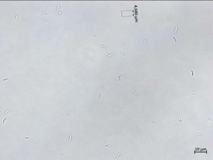 Cytospora_chrysosperma_3