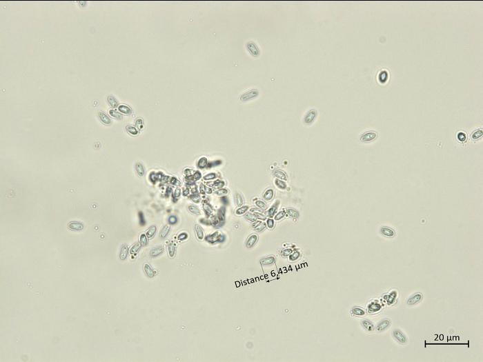 Diaporthe_vaccinii_3