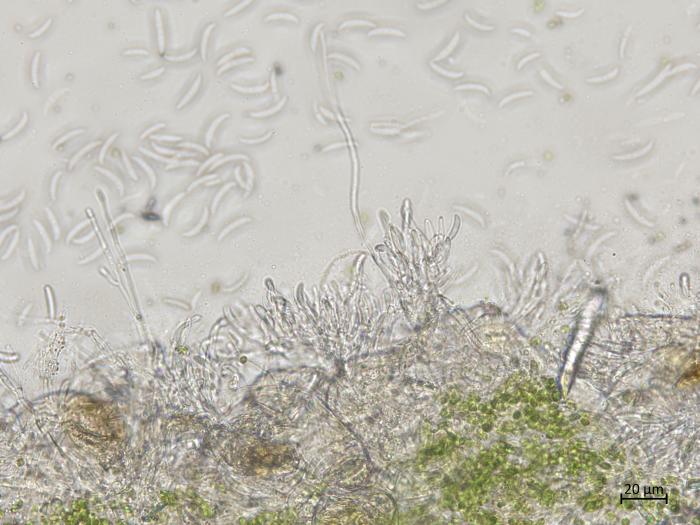 Fusarium_graminearum_2