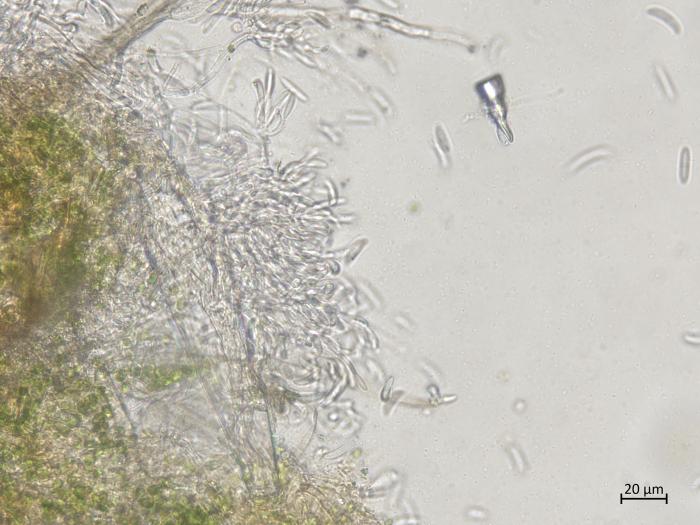 Fusarium_graminearum_1