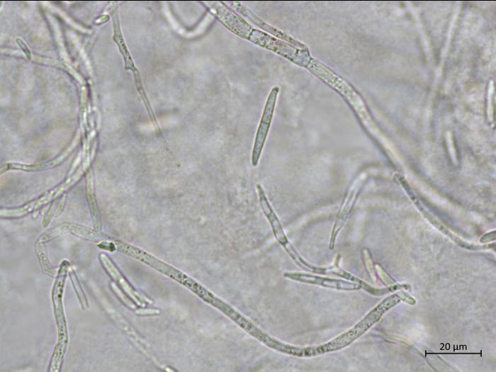Fusarium_proliferatum_2