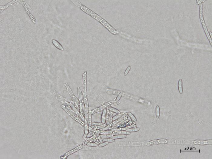 Fusarium_sporotrichioides_1