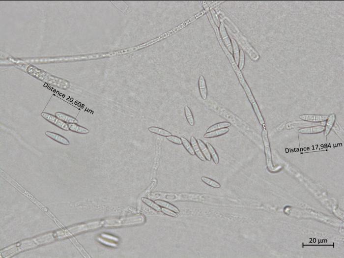 Fusarium_sporotrichioides_3