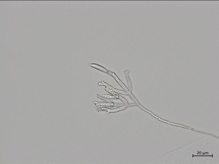 Fusarium_sporotrichioides_4