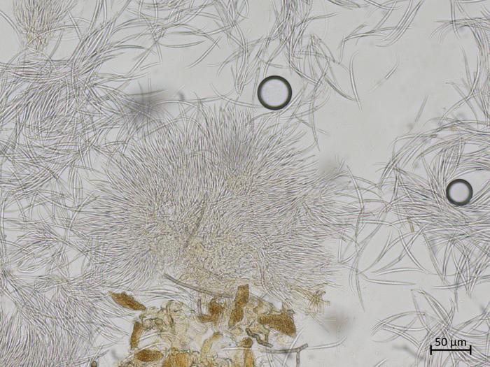 Fusarium_sp_1