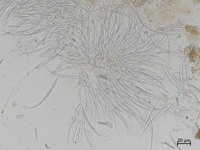 Fusarium_tricinctum_1