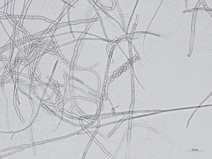 Monilinia_polystroma_2