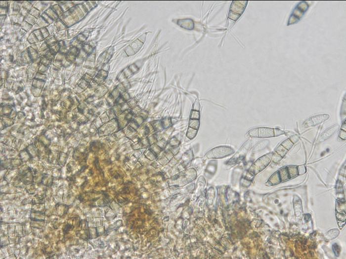 Neopestalotiopsis_clavispora_1