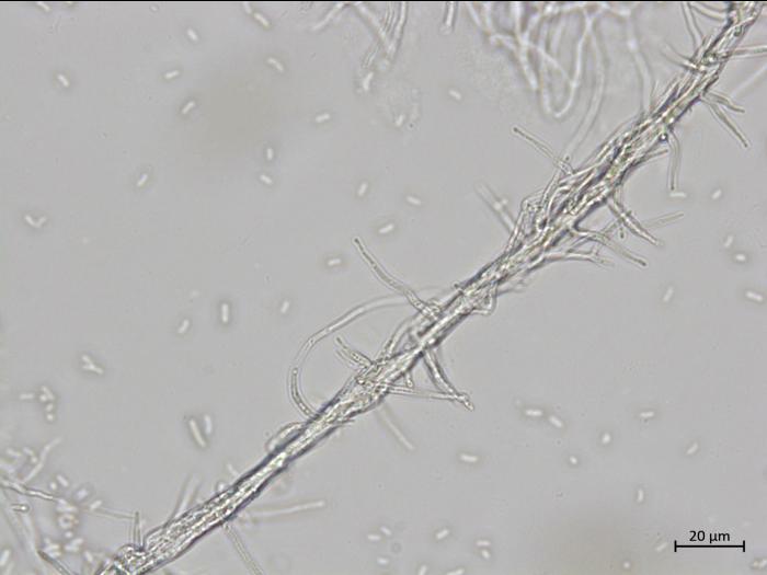 Phaeoacremonium_fraxinopennsylvanicum_2