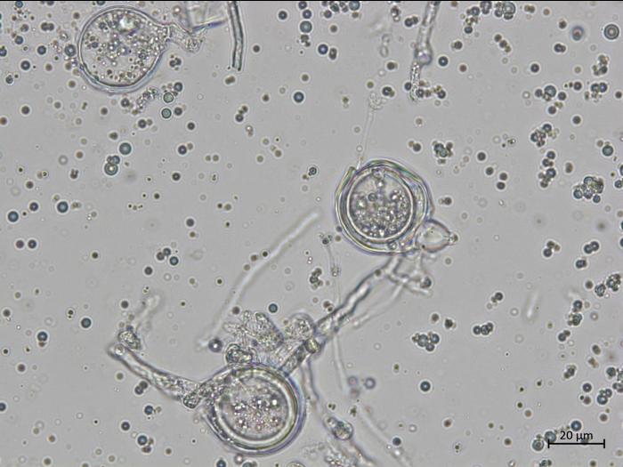 Phytophthora_cactorum_11