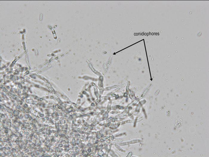 Cadophora_luteo-olivacea_9