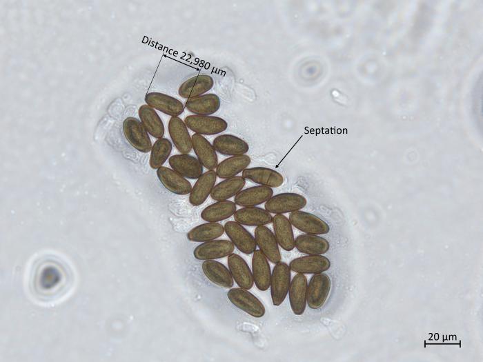 Diplodia_seriata_13